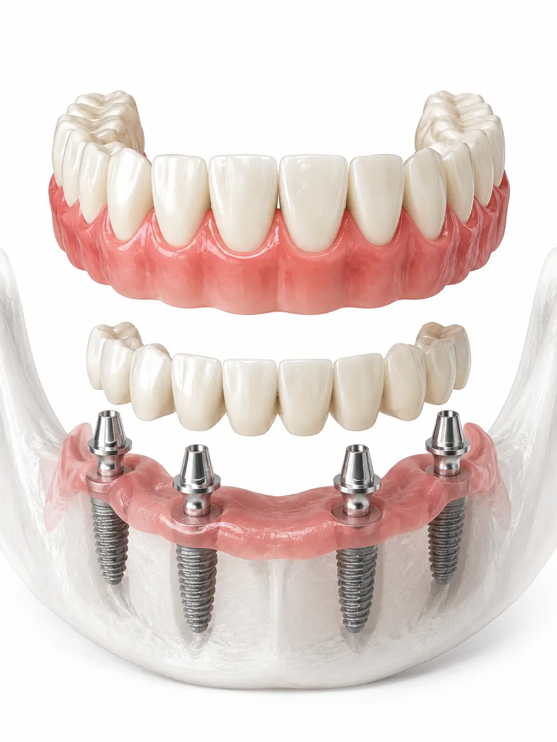 Smile Transformation